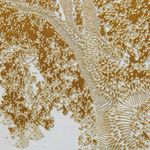 Pearl-Splatter-Patterned-Wall-Art